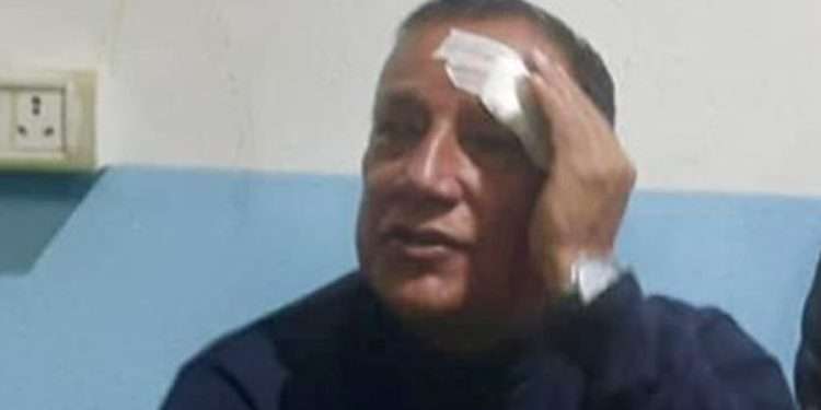 NC condemns assault on Province President Thapa