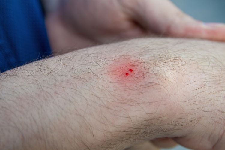 Snakebite treatment centre awaiting doctors for last six years